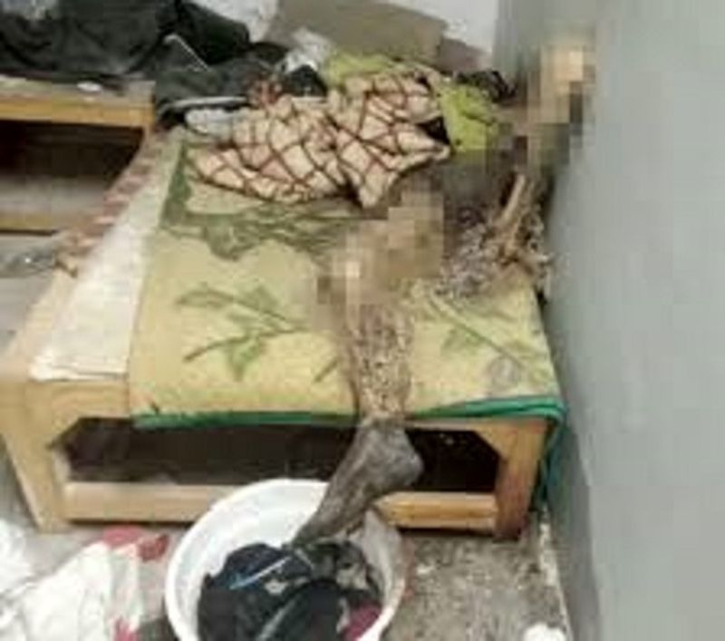 مردی که روی تختخواب بعد از 9 ماه تبدیل به اسکلت شد