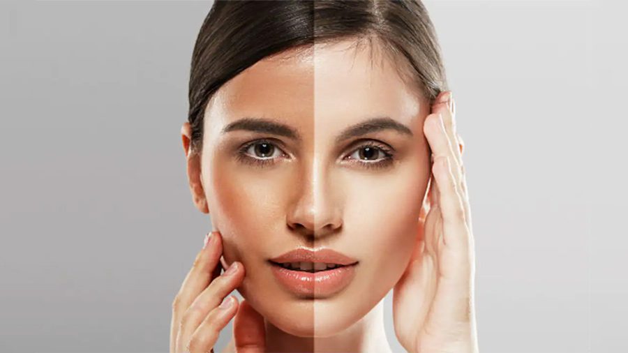 دلیل بدرنگ شدن پوست صورت چیست؟