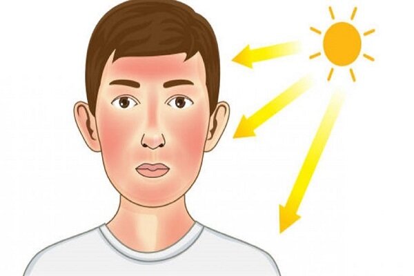 سرطان پوست و پیشگیری از آن/ هشدار برای افزایش اشعه فرابنفش