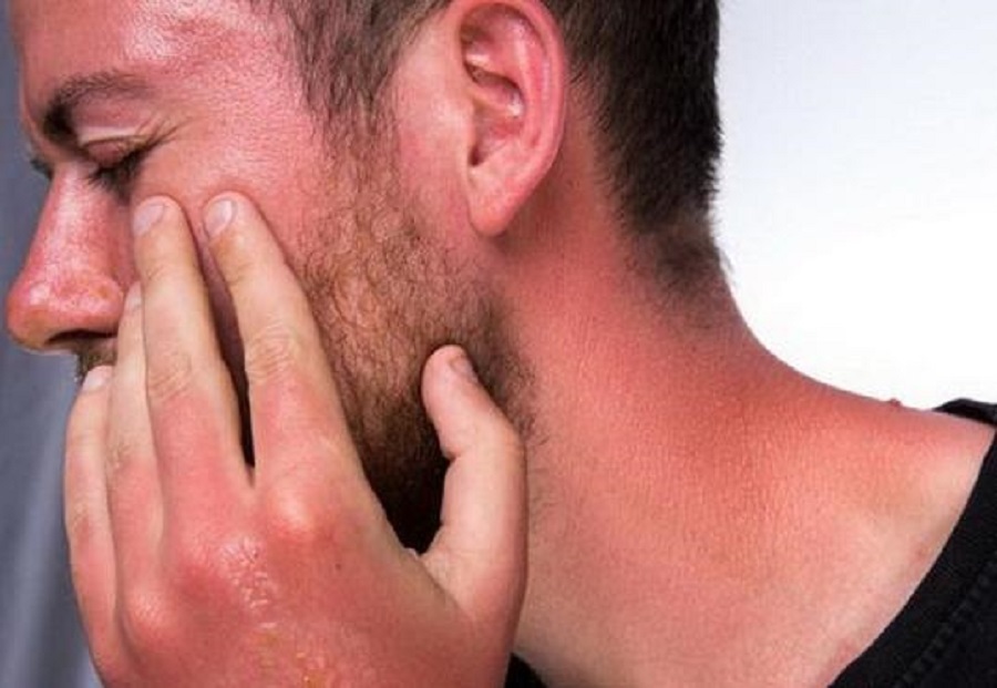 سرطان پوست و پیشگیری از آن/ هشدار برای افزایش اشعه فرابنفش