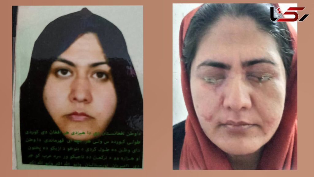 اسیدپاشی برادر به خواهر برای جلوگیری از کار کردن او + فیلم