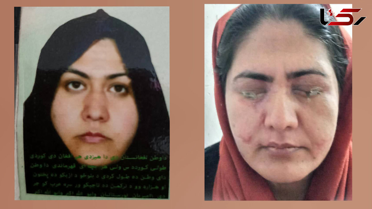 اسیدپاشی برادر به خواهر برای جلوگیری از کار کردن او + فیلم