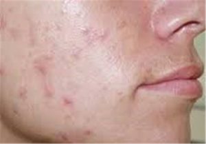 سولاریوم دستگاه سرطان زا! هشدار برای افرادی که به این دستگاه علاقه دارند 2 سولاریوم دستگاه سرطان زا! هشدار برای افرادی که به این دستگاه علاقه دارند