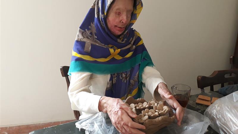 40 سال حبس، قصاص و شلاق در انتظار اسید پاشی در اراک 1 40 سال حبس، قصاص و شلاق در انتظار اسید پاشی در اراک