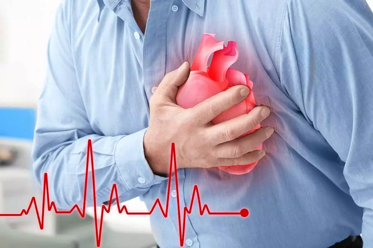 10 سال کاهش سن سکته قلبی ایرانیان نسبت به اروپایی‌ها