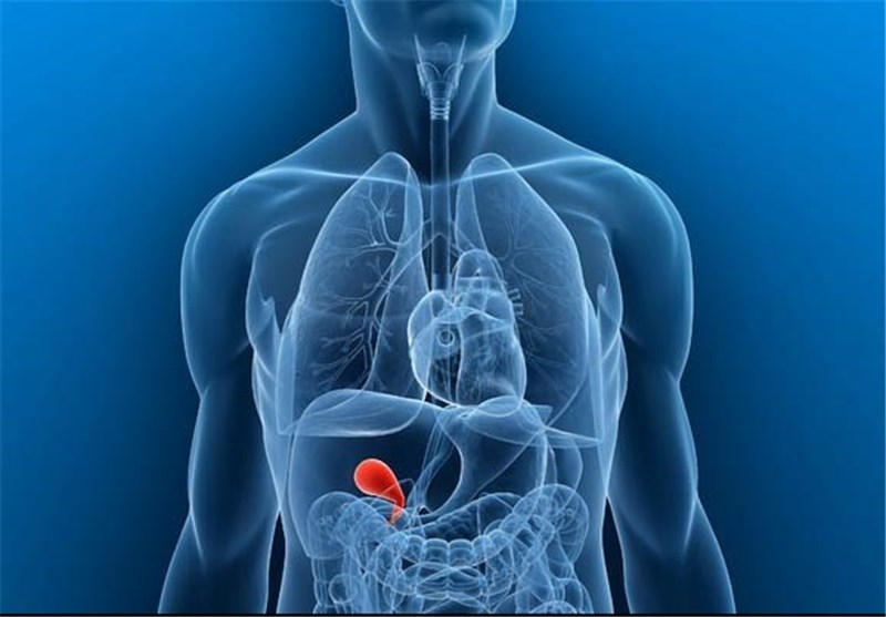 برداشتن کیسه صفرا تنها راه خلاصی از سنگ‌های صفراوی است؟