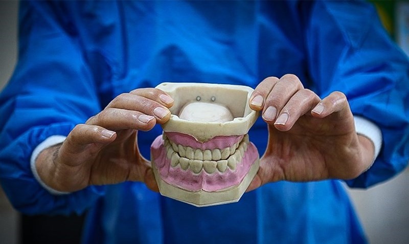 دانش‌آموزان دبستانی به طور میانگین ۵ دندان پوسیده دارند/اجرای پویش سلامت دهان از هفته آینده