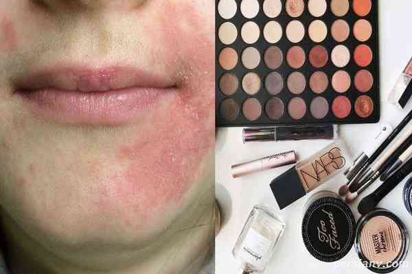 مواد آرایشی چرا حساسیت‌زا هستند علائم و دلایل بروز حساسیت